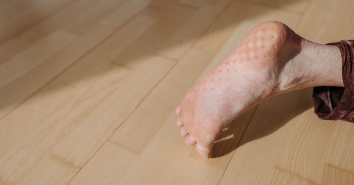 보행동결 대처 신호는 무엇이 잘 맞나요?